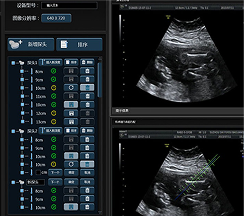 武漢睿影醫(yī)療科技超聲系統軟件界面設計